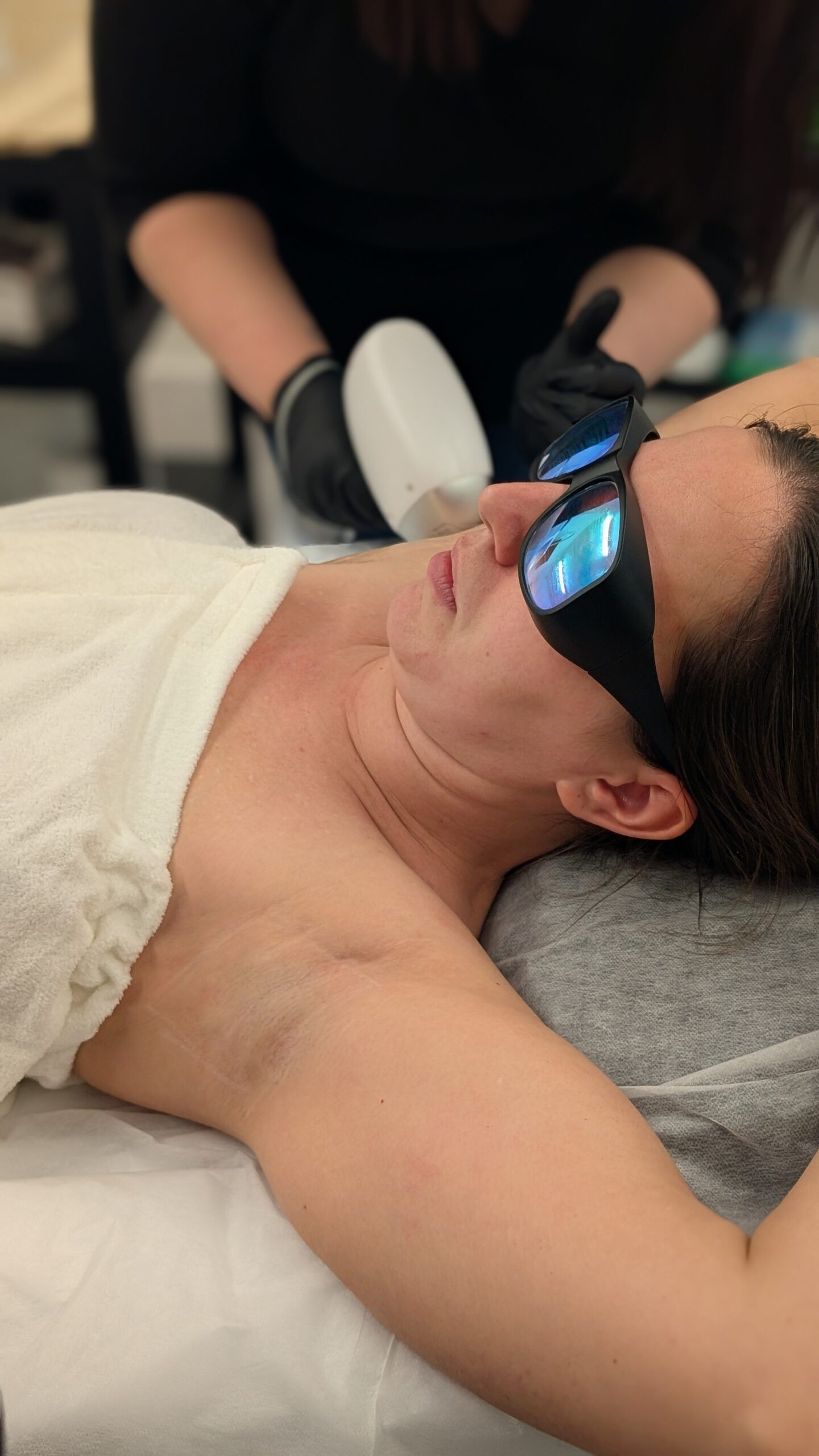 laserhairremoval