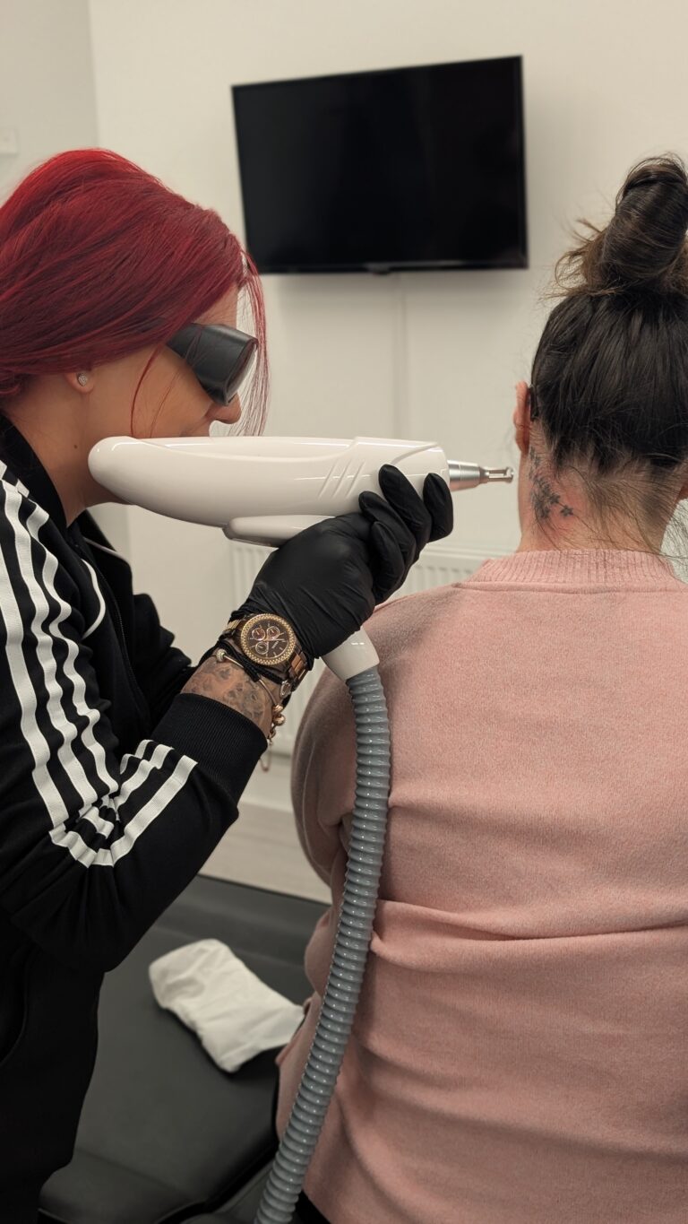 lasertattooremoval