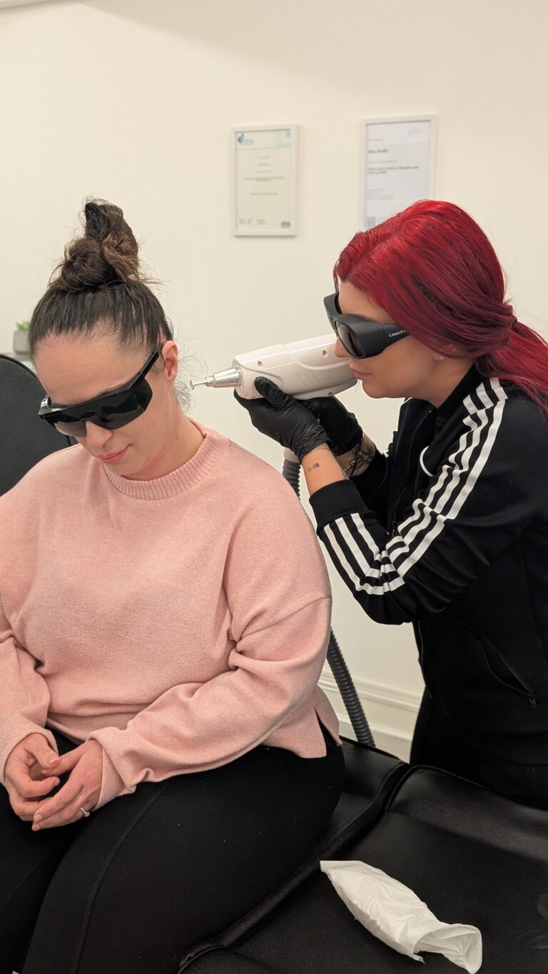 lasertattooremoval