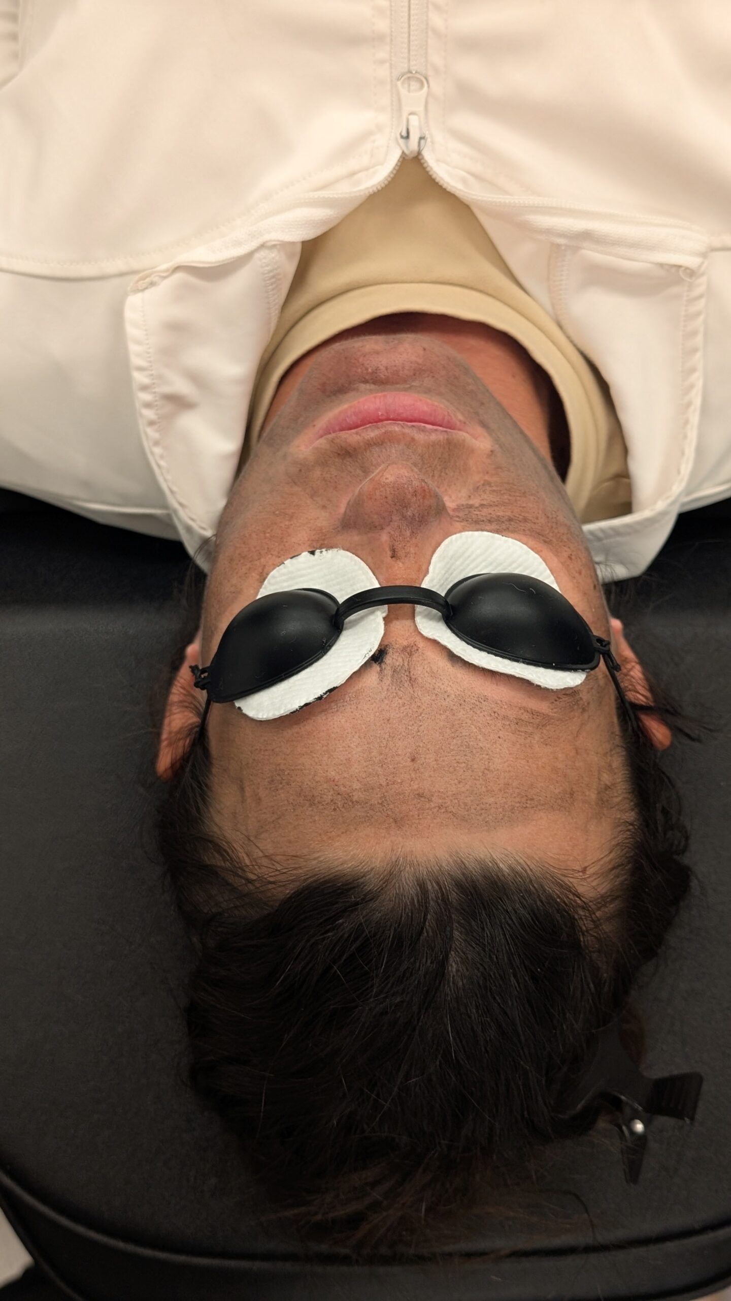 carbonlaserfacial