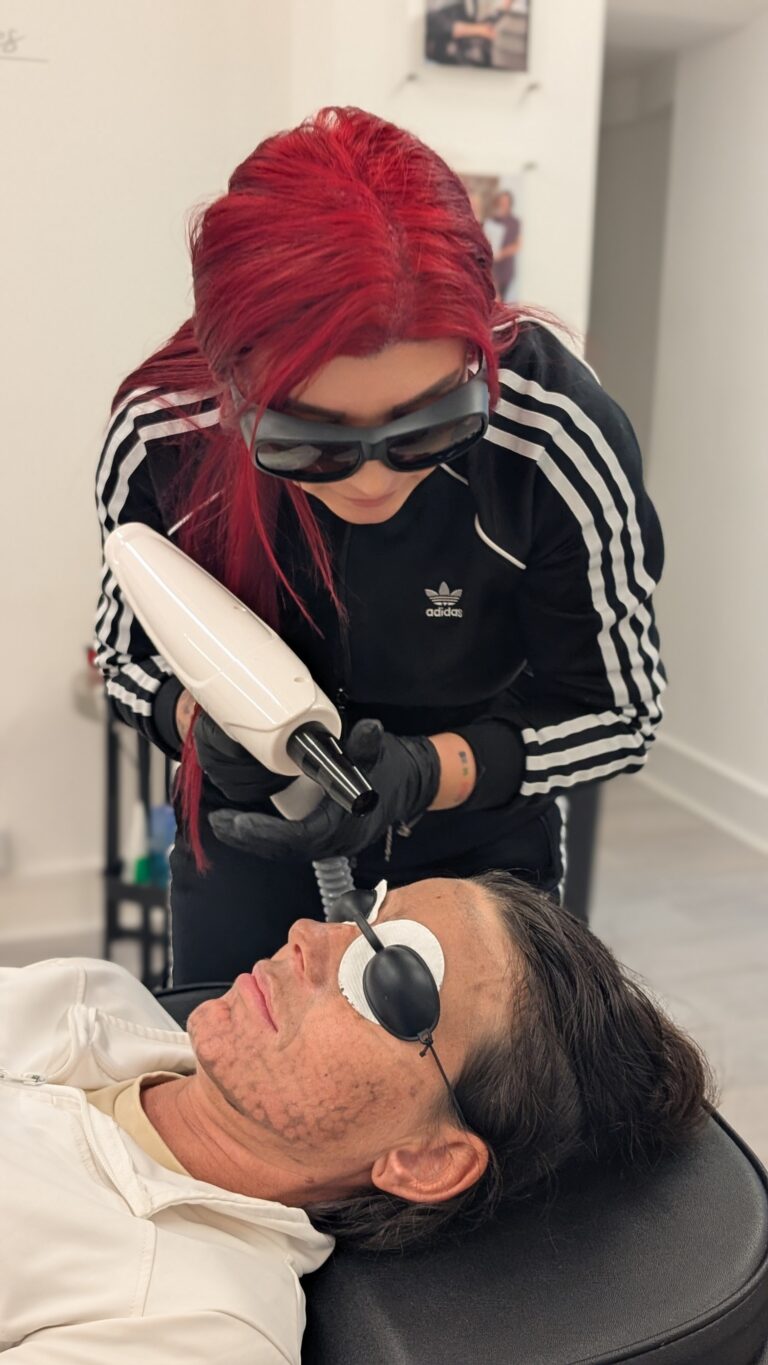 carbonlaserfacial