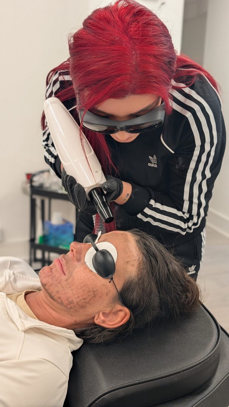 carbonlaserfacial