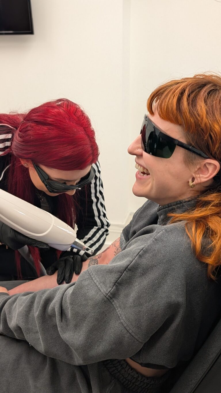 lasertattooremoval